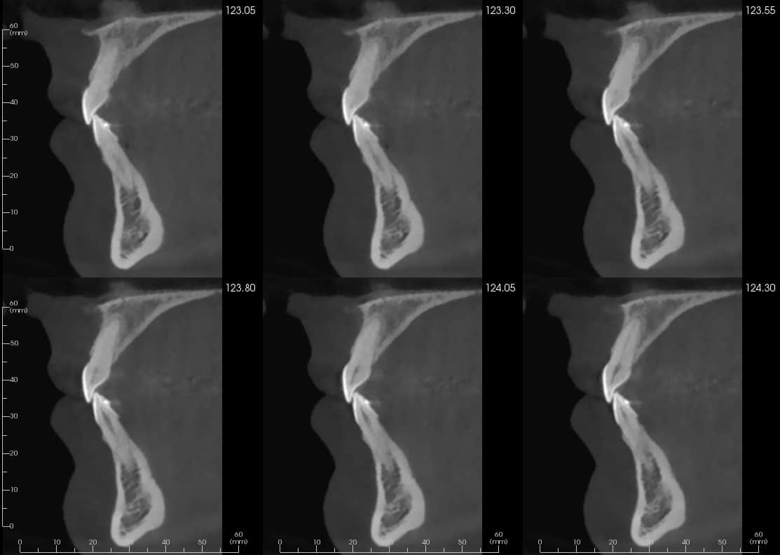 Cross sections from CBCT scans sent in for a CBCT reports.