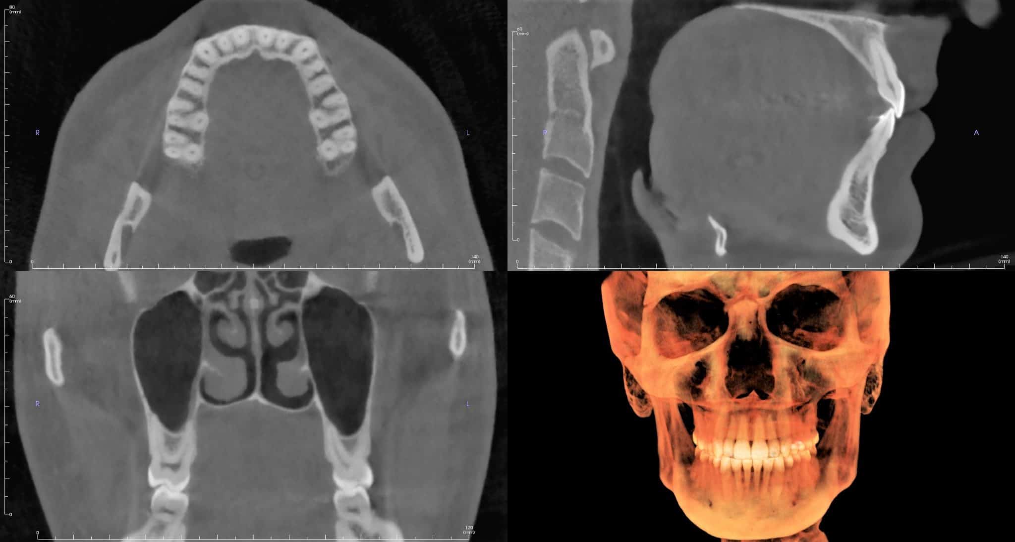 CBCT: What is it and how does it work? - Radiodontics