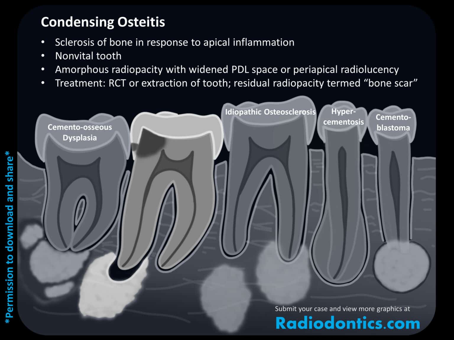 Apical radiopacities radiodontics